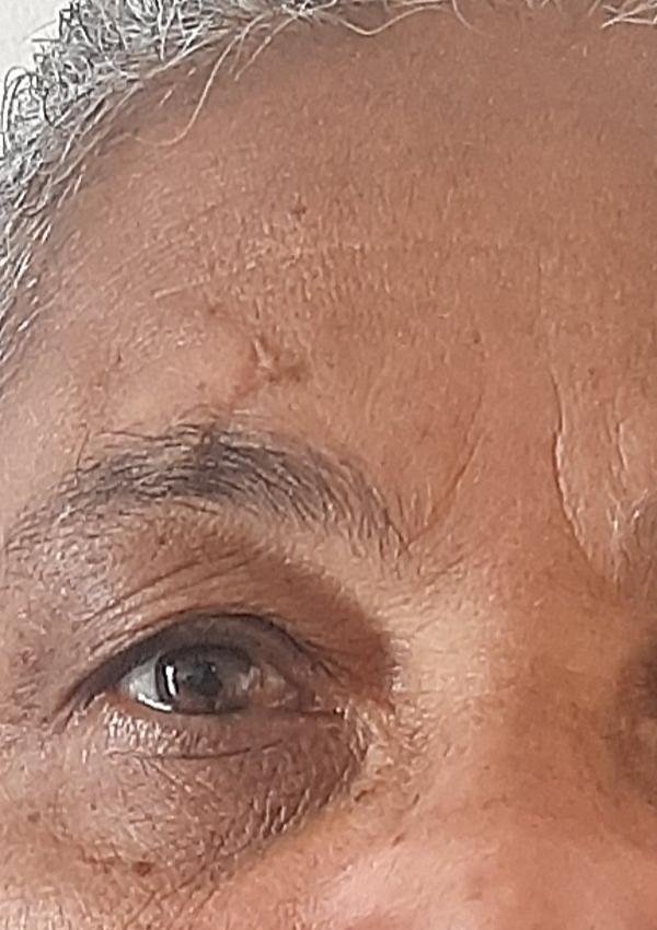 Alternativas Felizes Para Quando o Sol Não Vem