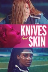 Knives and Skin