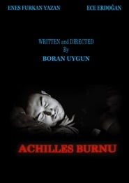 Achilles Burnu