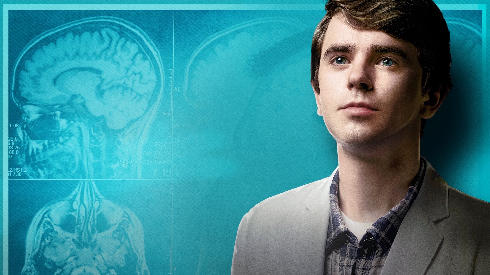 The Good Doctor Season 1 Episode 8 : Apple