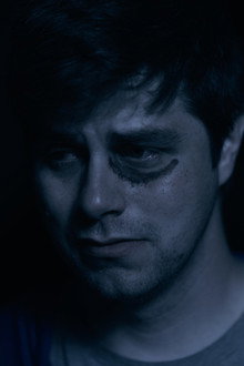 Atrophy