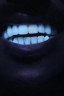 Des dents blanches... au rire jaune !