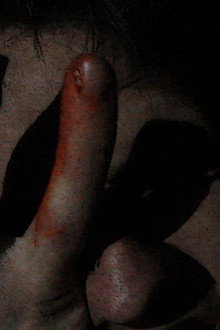 Blood in the Woods