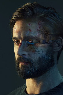 Trauma