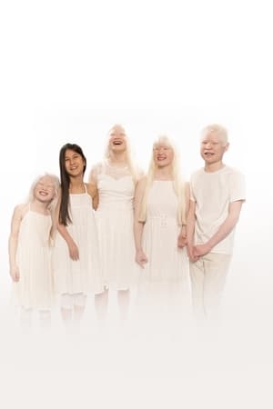 Image Born with Albinism