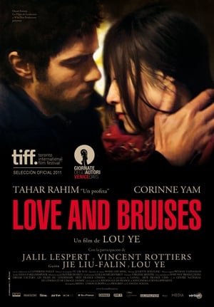 Image Love and Bruises