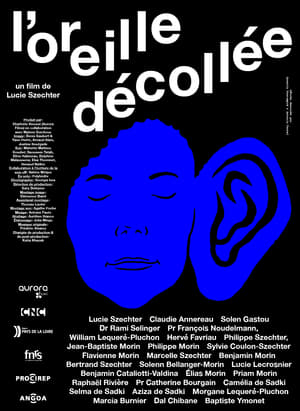 Image L'Oreille décollée