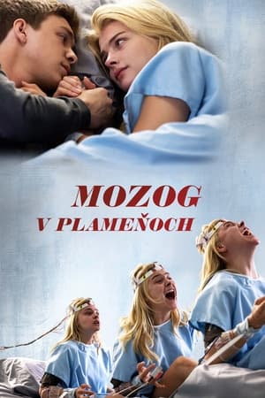 Image Mozog v plameňoch