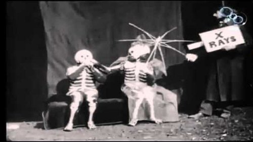 The X-Ray Fiend
