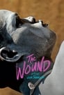 3-The Wound