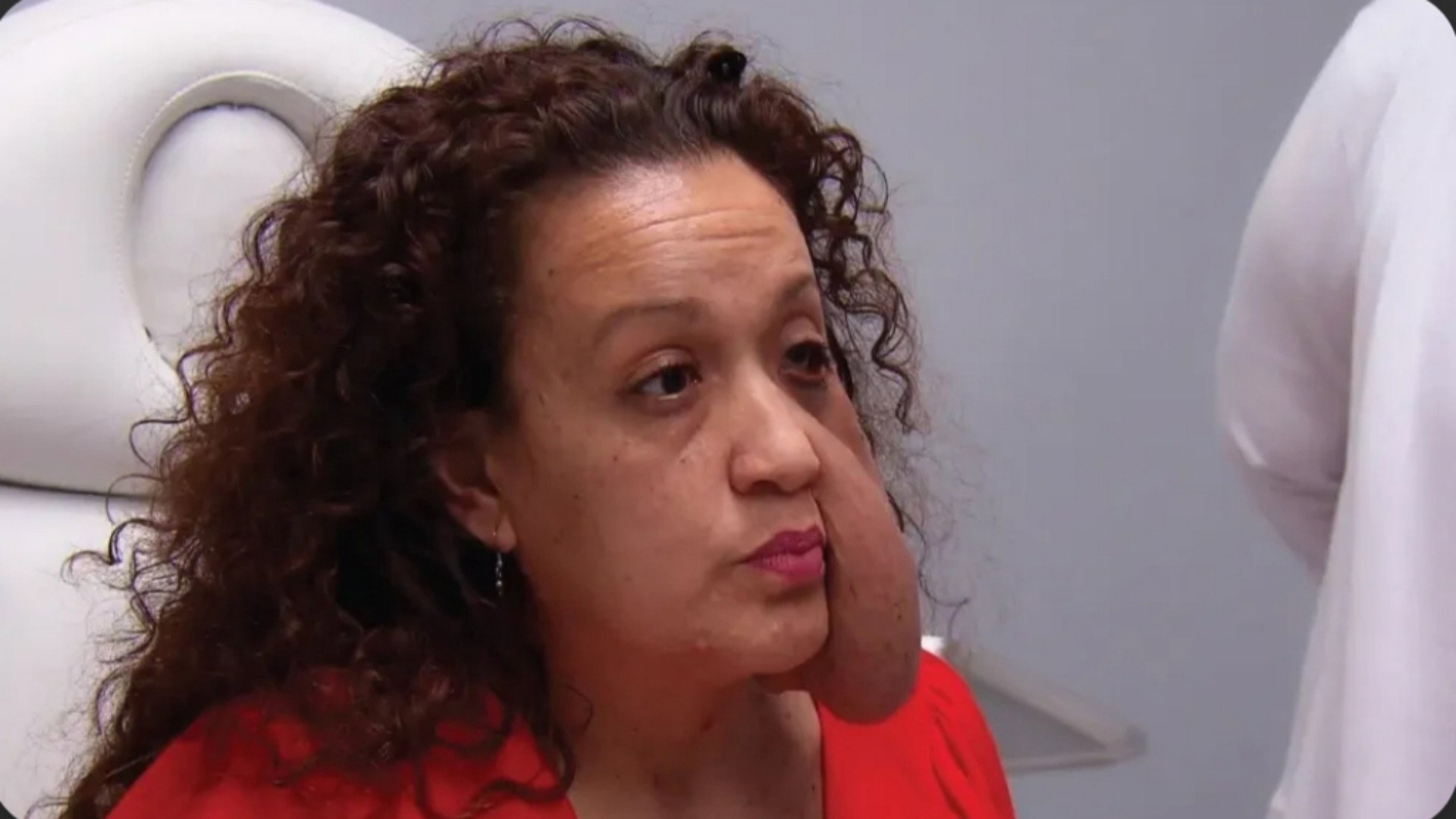 A still from Tumor Tragedy