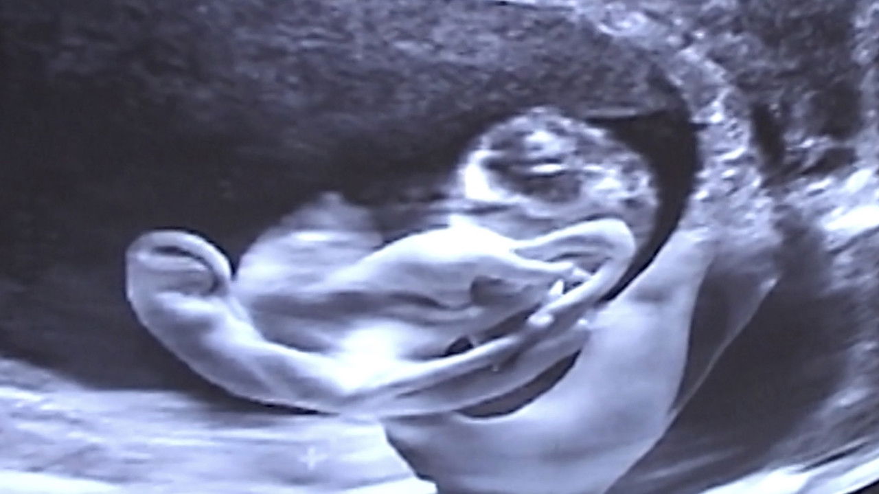 Backdrop image for movie Castration Movie Anthology iii. Year of the Hyaena