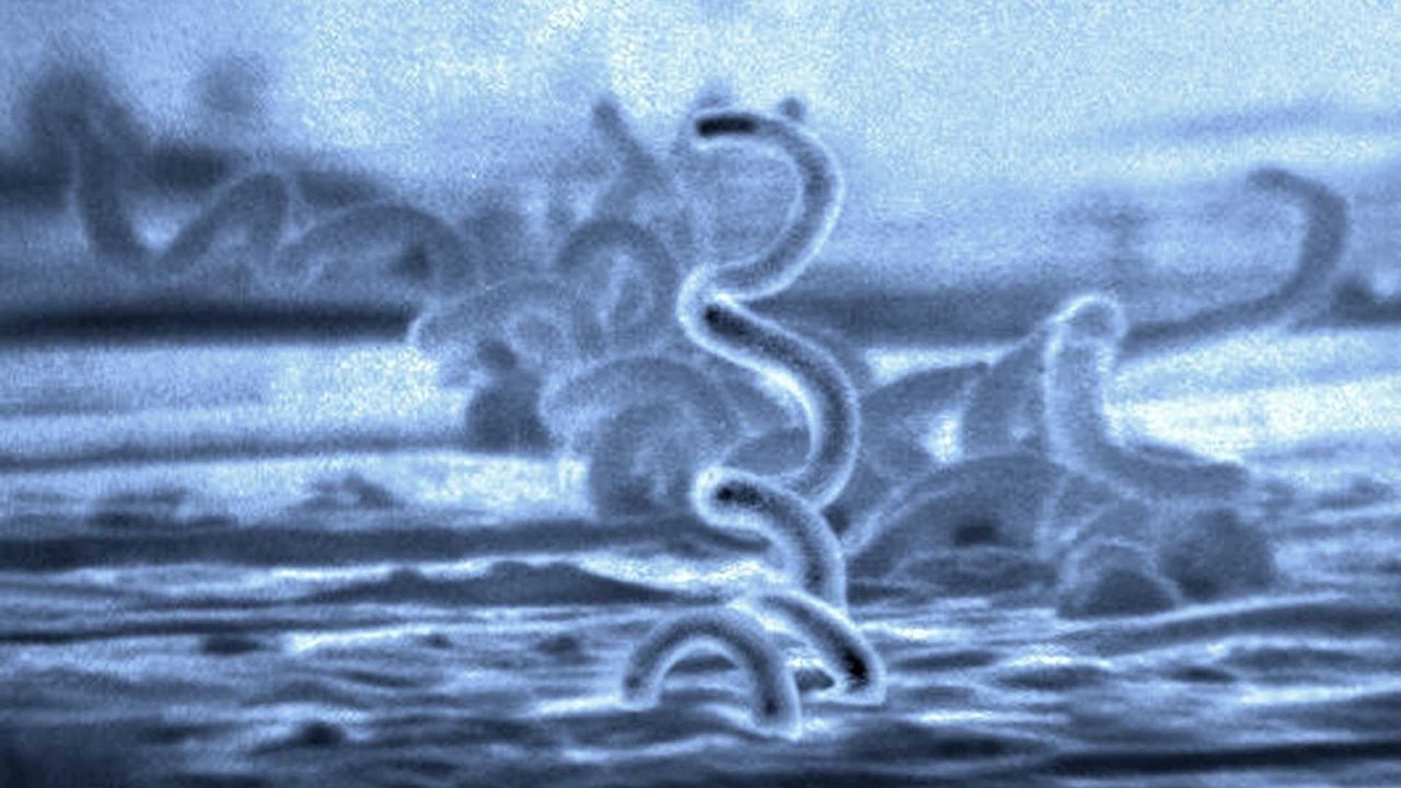 Backdrop image for movie Under Our Skin