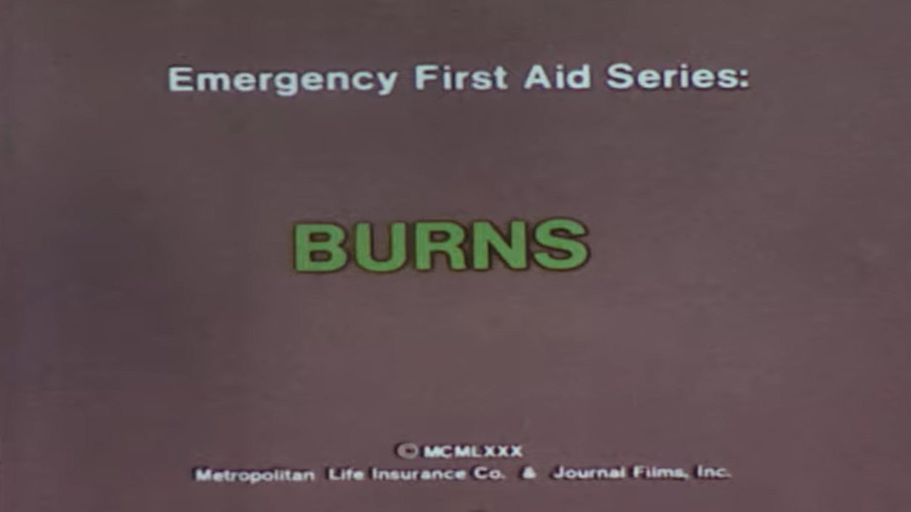 Backdrop image for movie Emergency First Aid Series: Burns