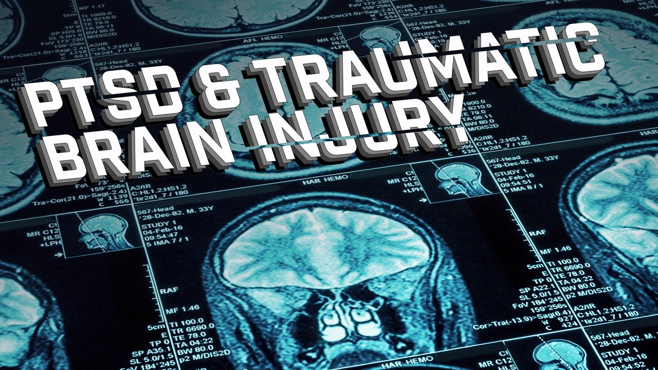 Backdrop image for movie Joel Hunt: Traumatic Brain Injury (TBI)