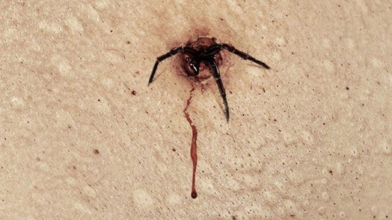 Backdrop image for movie The Plague