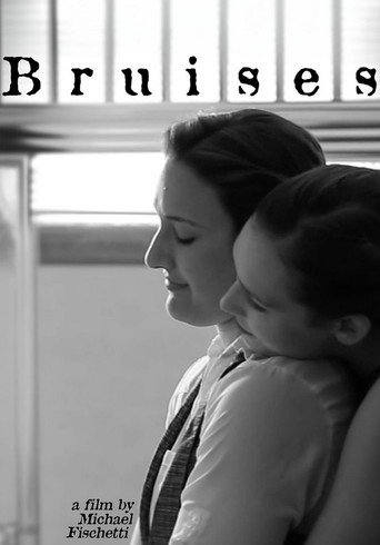 Bruises