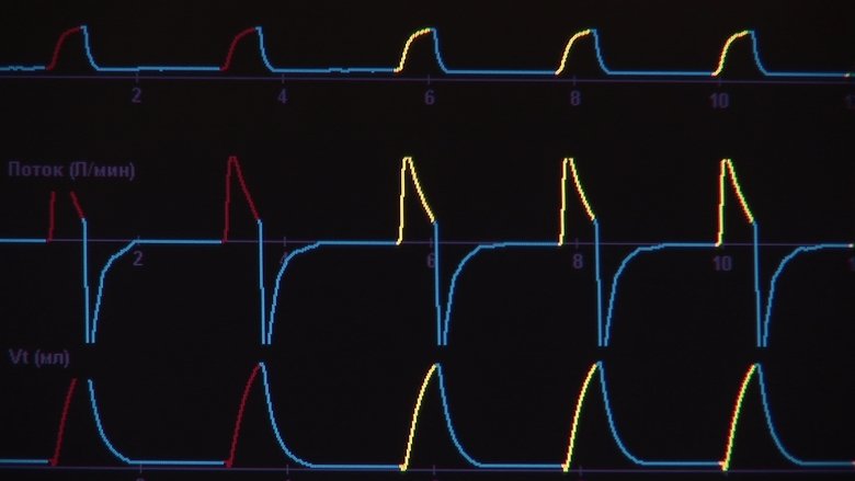 Backdrop image for movie Linar