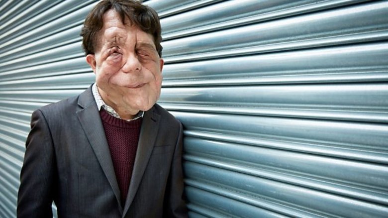 Backdrop image for movie The Ugly Face of Disability Hate Crime