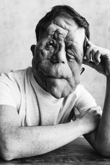 Adam Pearson photo 2