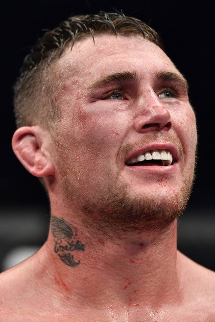 Darren Till photo 2