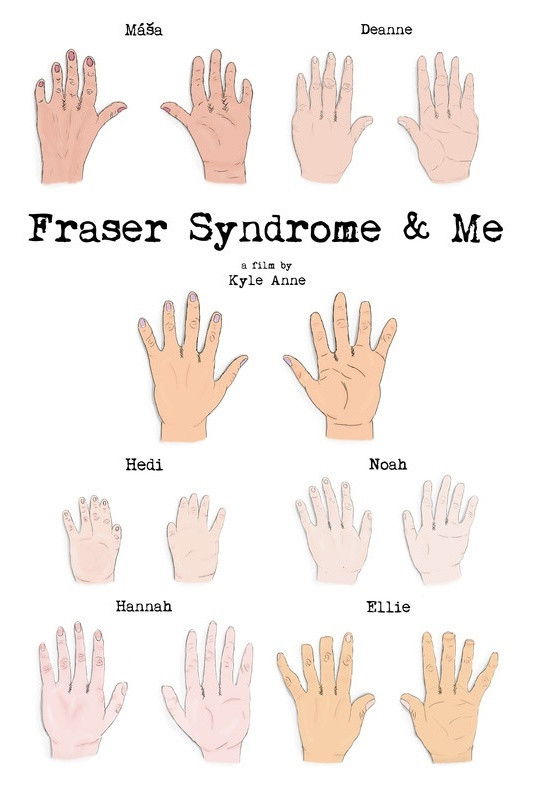 Fraser Syndrome & Me poster