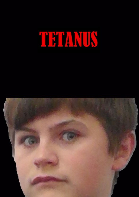 Tetanus poster