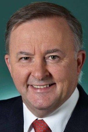 Foto de Anthony Albanese