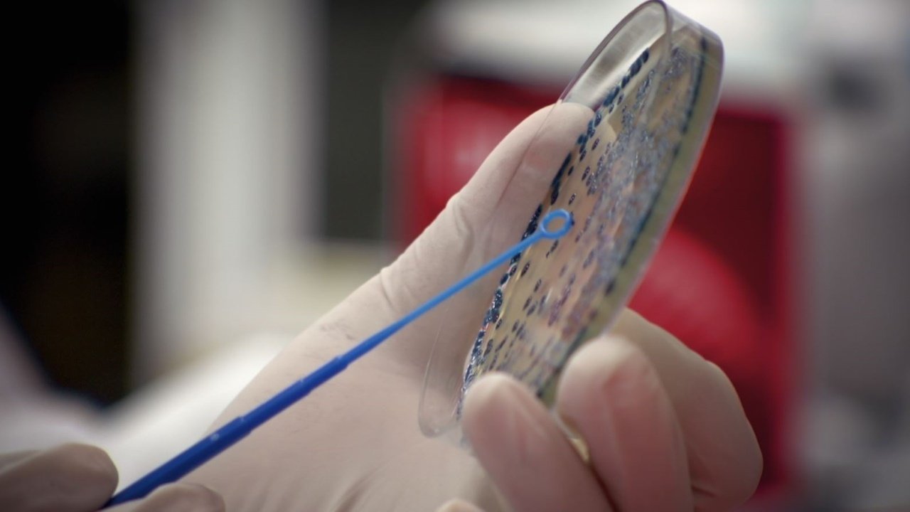 The Superbug Era