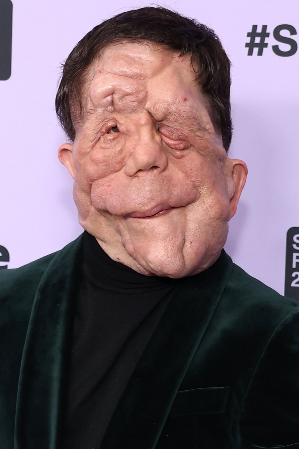 Foto de Adam Pearson