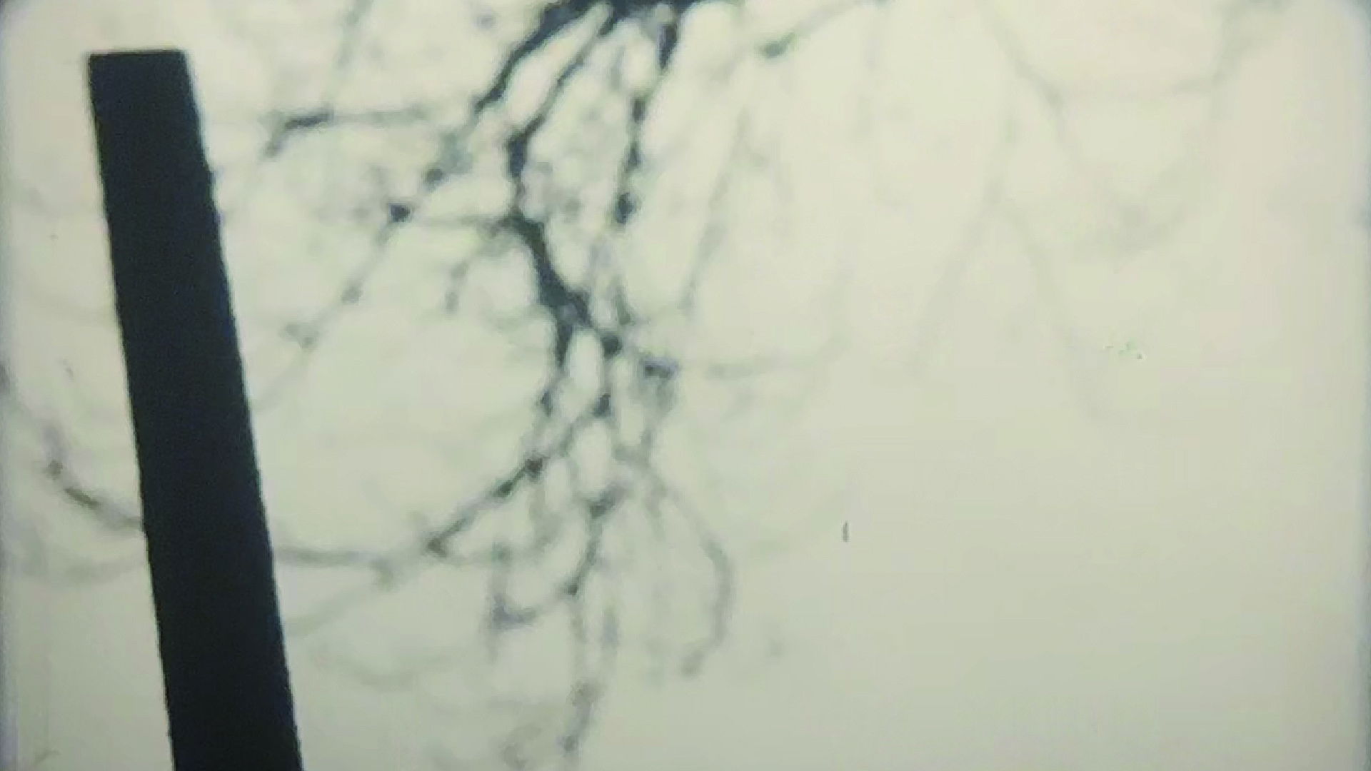 Your Death is My Delight