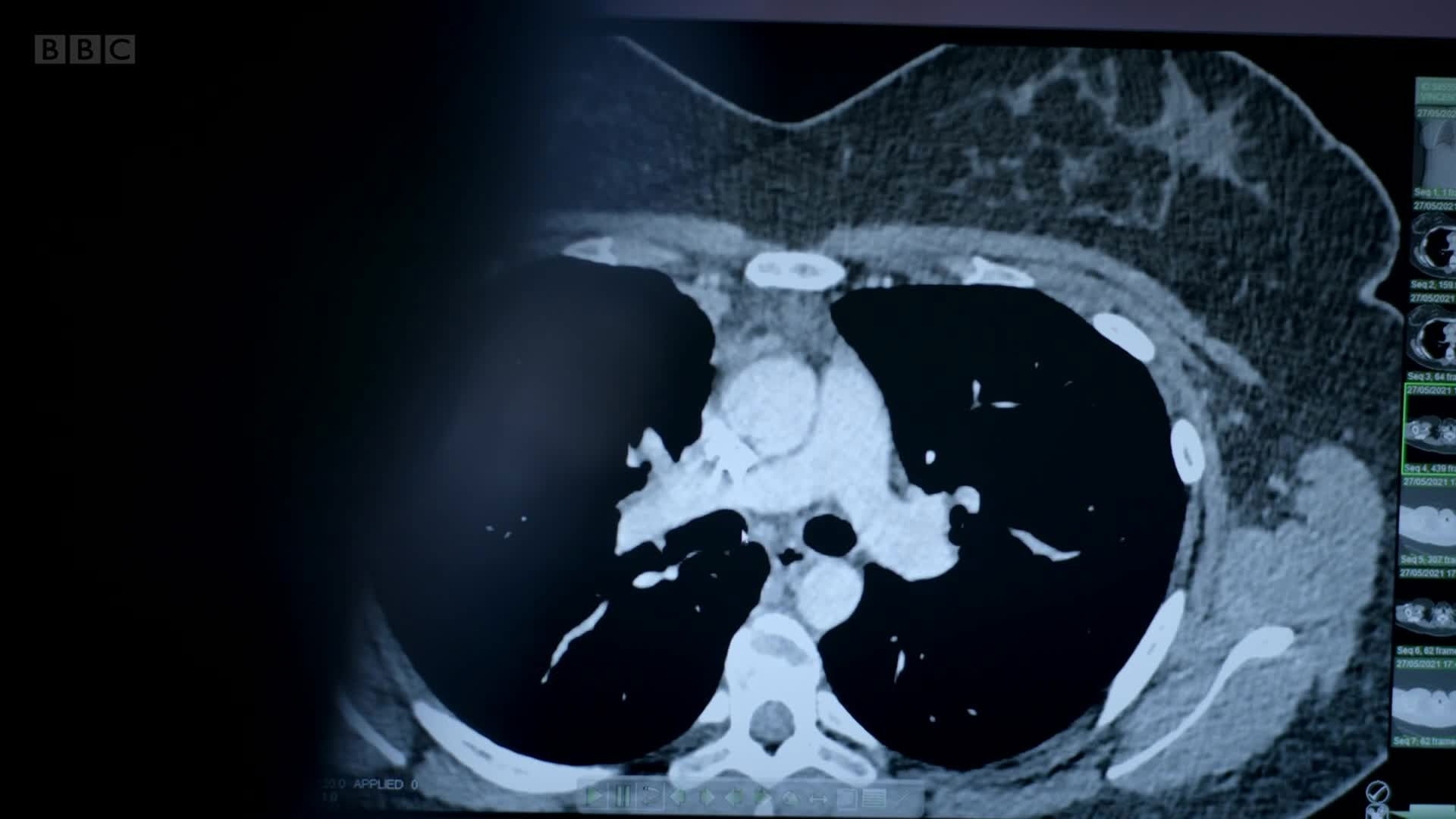 Putting It Back Together Again