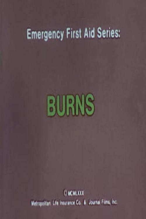 Poster de Emergency First Aid Series: Burns
