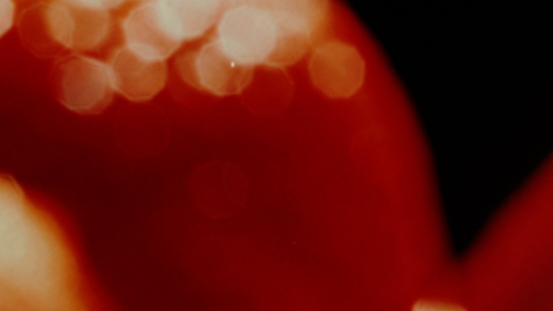 Strawberries (A Short Film)