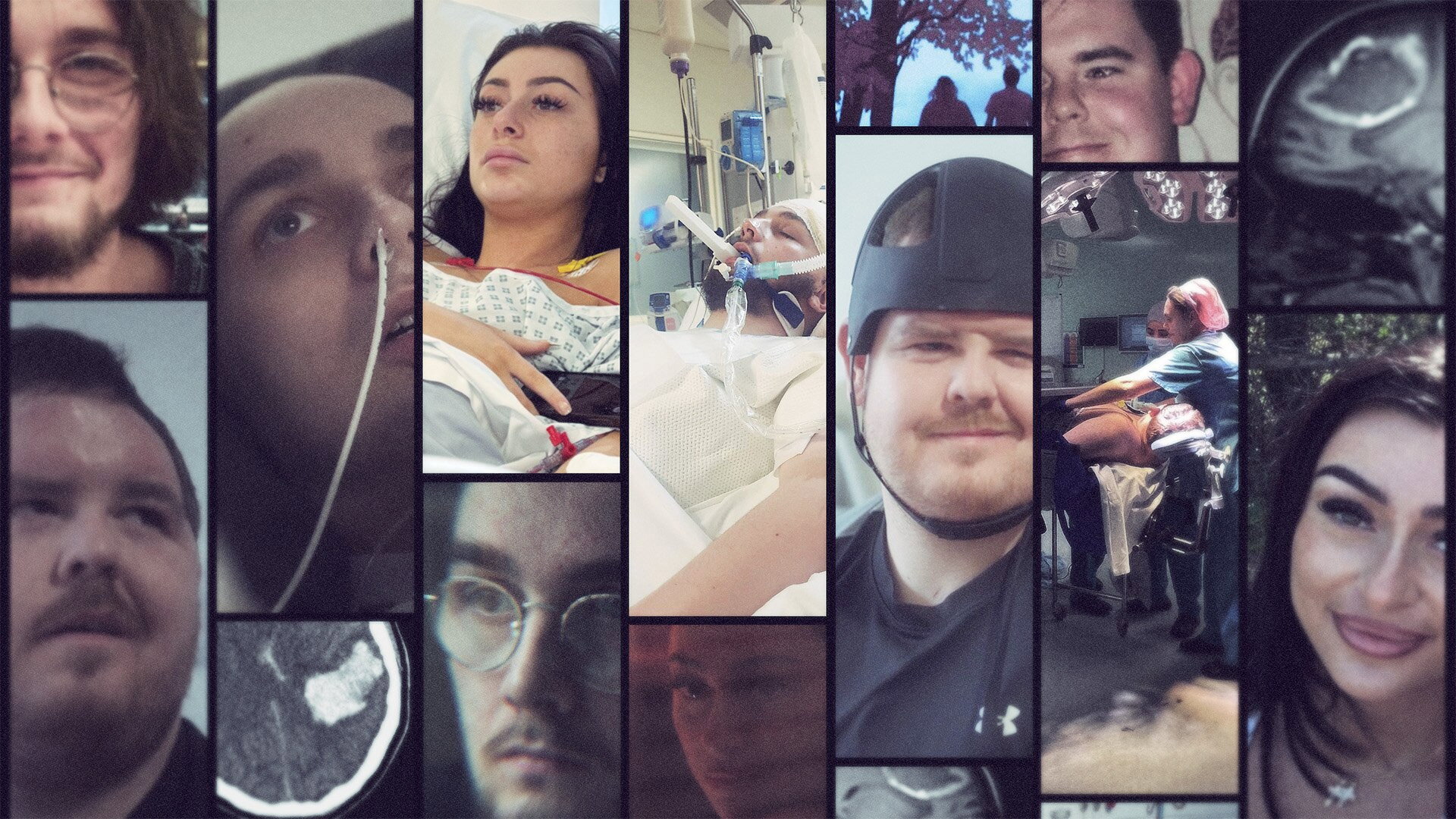 Trauma: My Broken Brain
