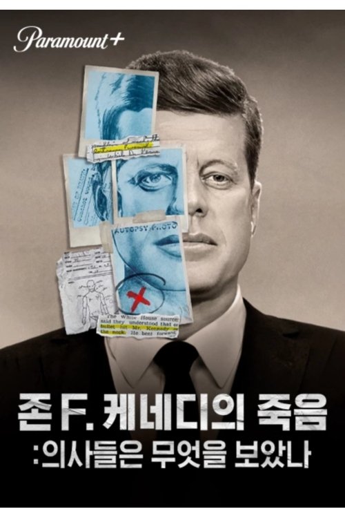 존. F 케네디의 죽음: 의사들은 무엇을 보았나