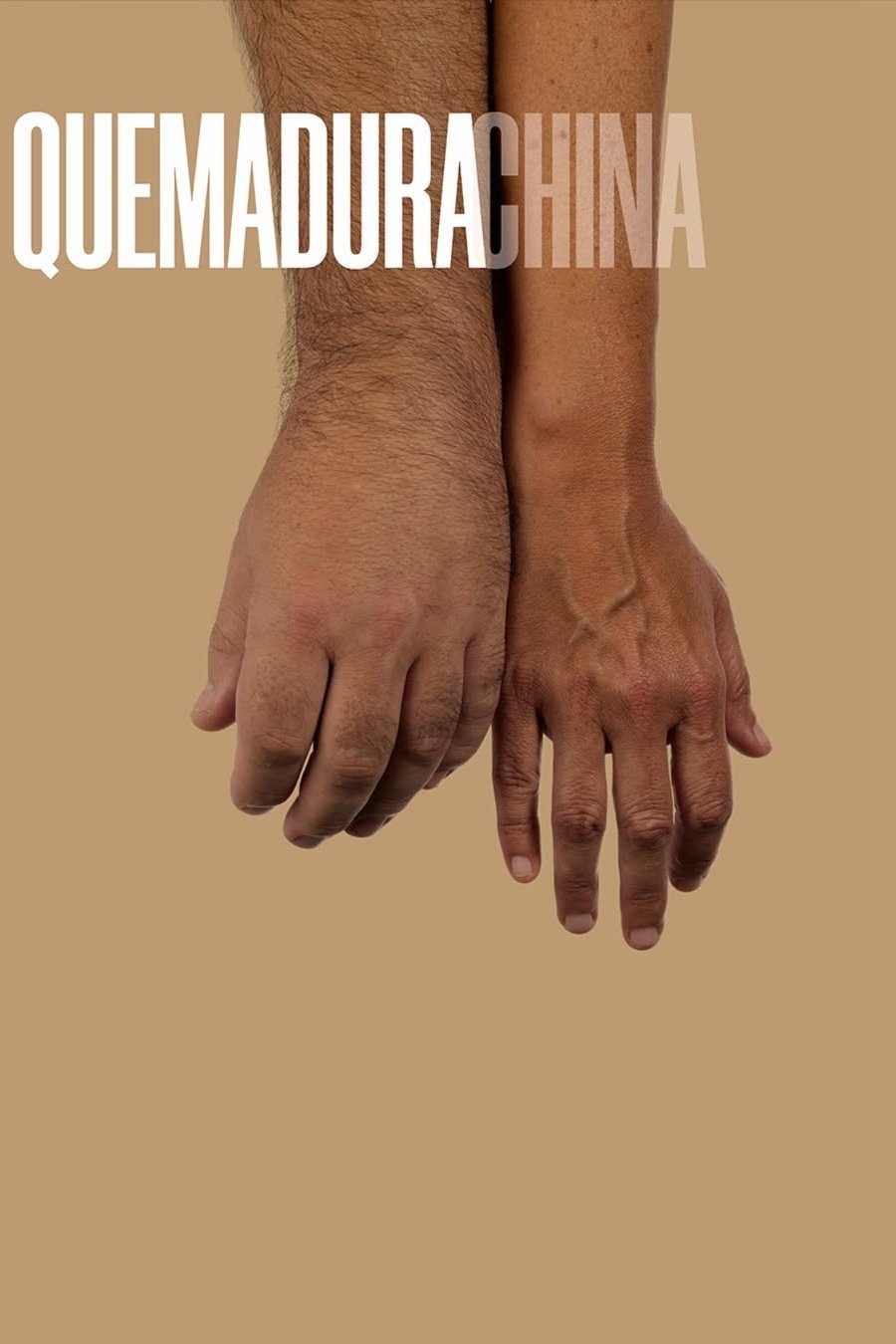 Poster de Quemadura china