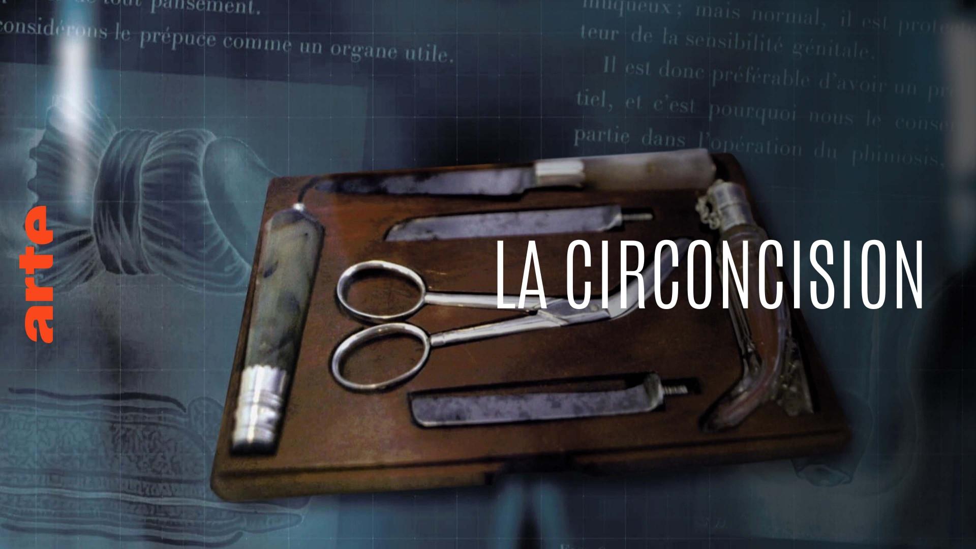 Circumcision: An ablation that raises questions