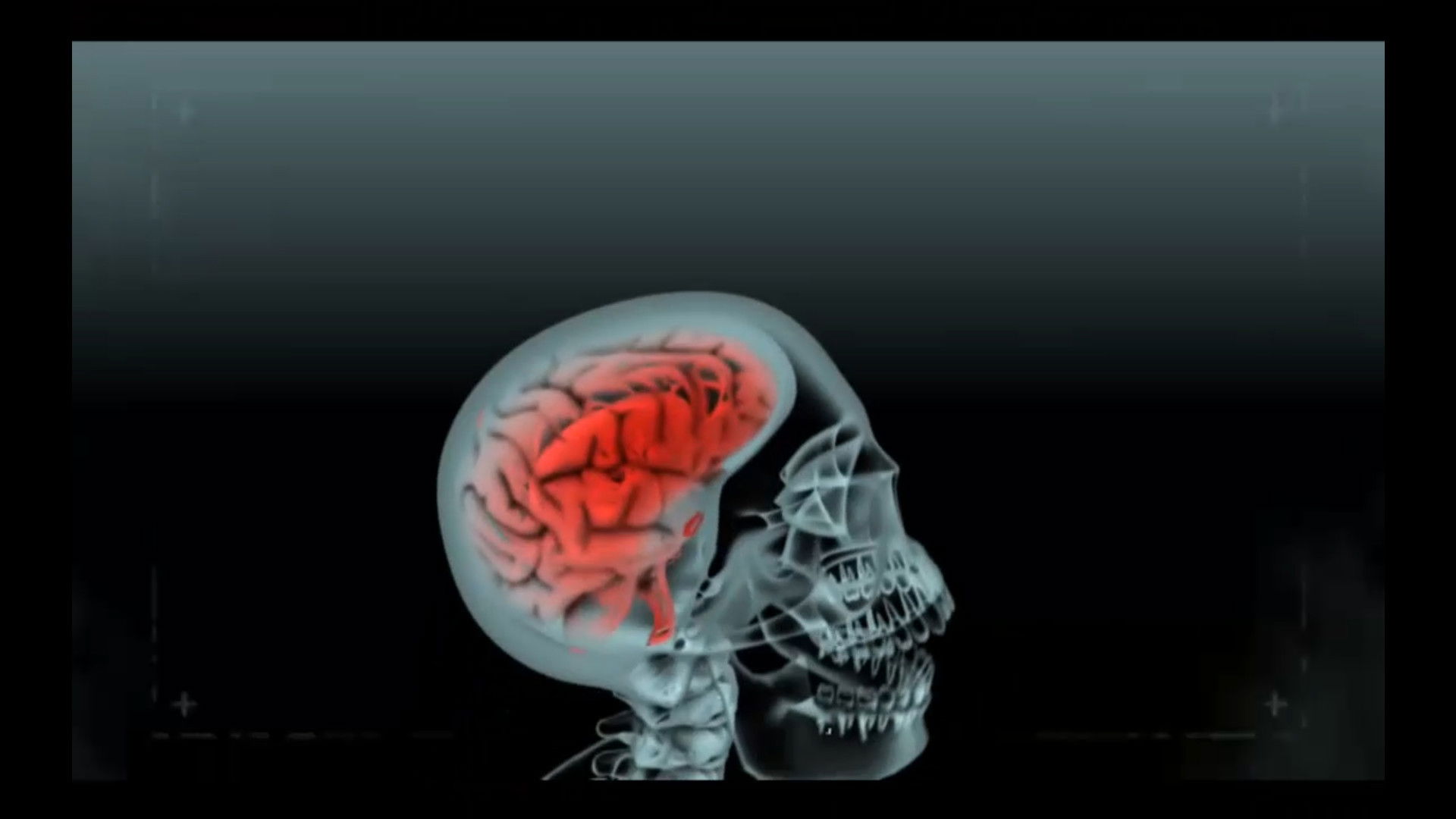 Stupid Is as Death Does