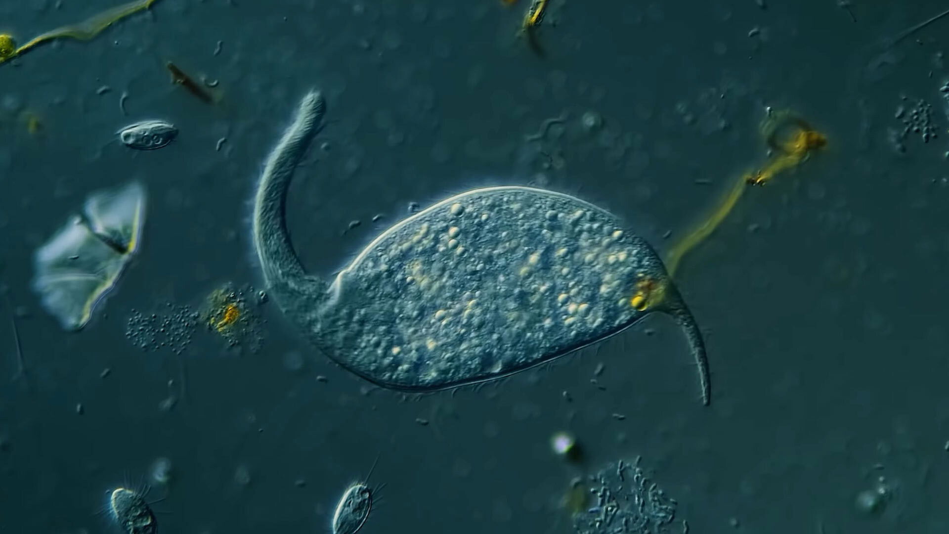 Dileptus: The Toxic Micro Elephant With an Insatiable Appetite