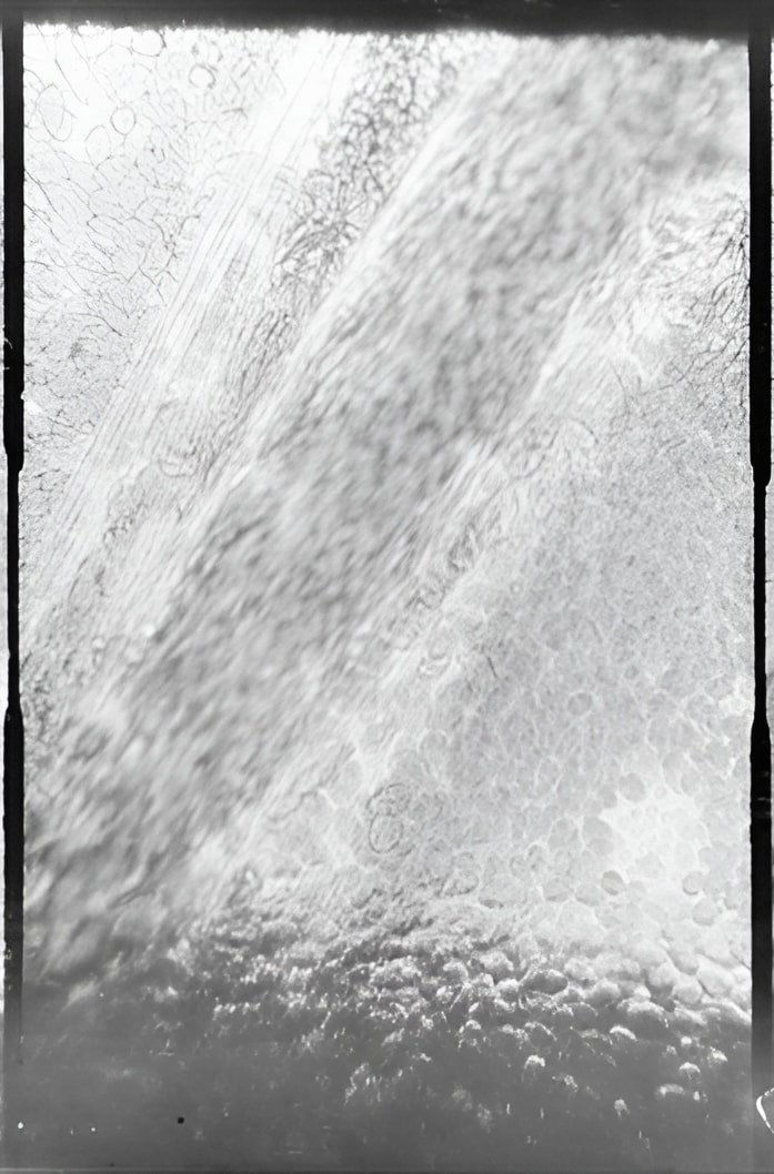 Poster de Déplacement des globules de sang dans un vaisseau capillaire