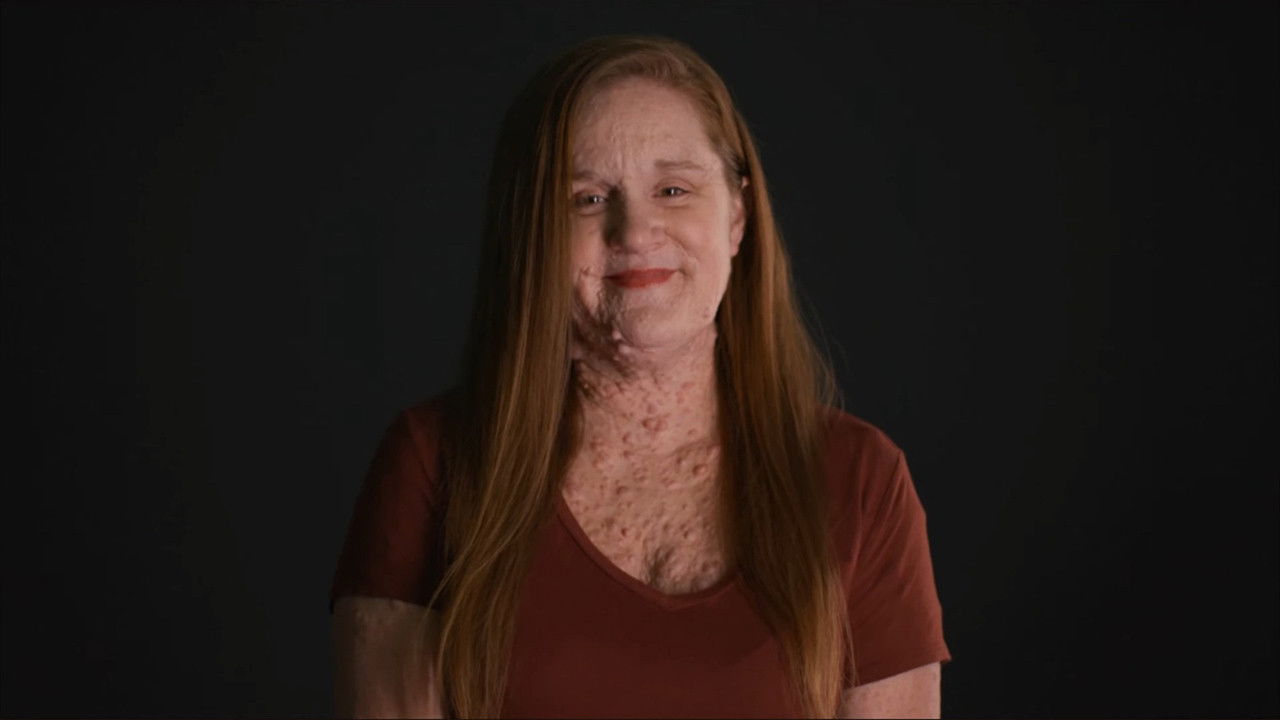 Tumors, Tumors, Everywhere