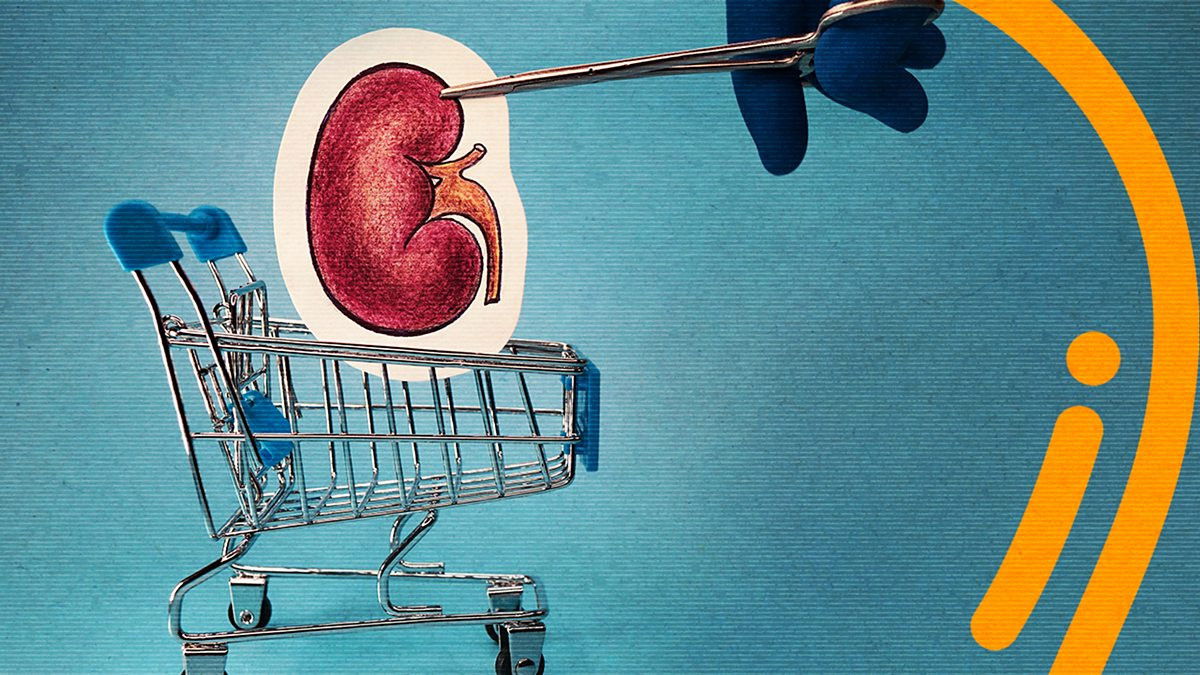 Should Human Kidneys Be Bought And Sold?