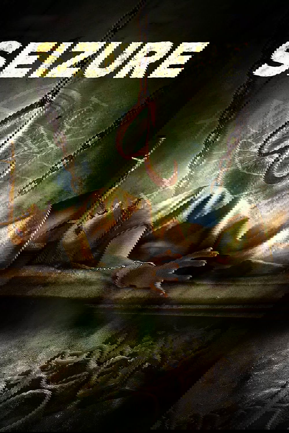 Seizure