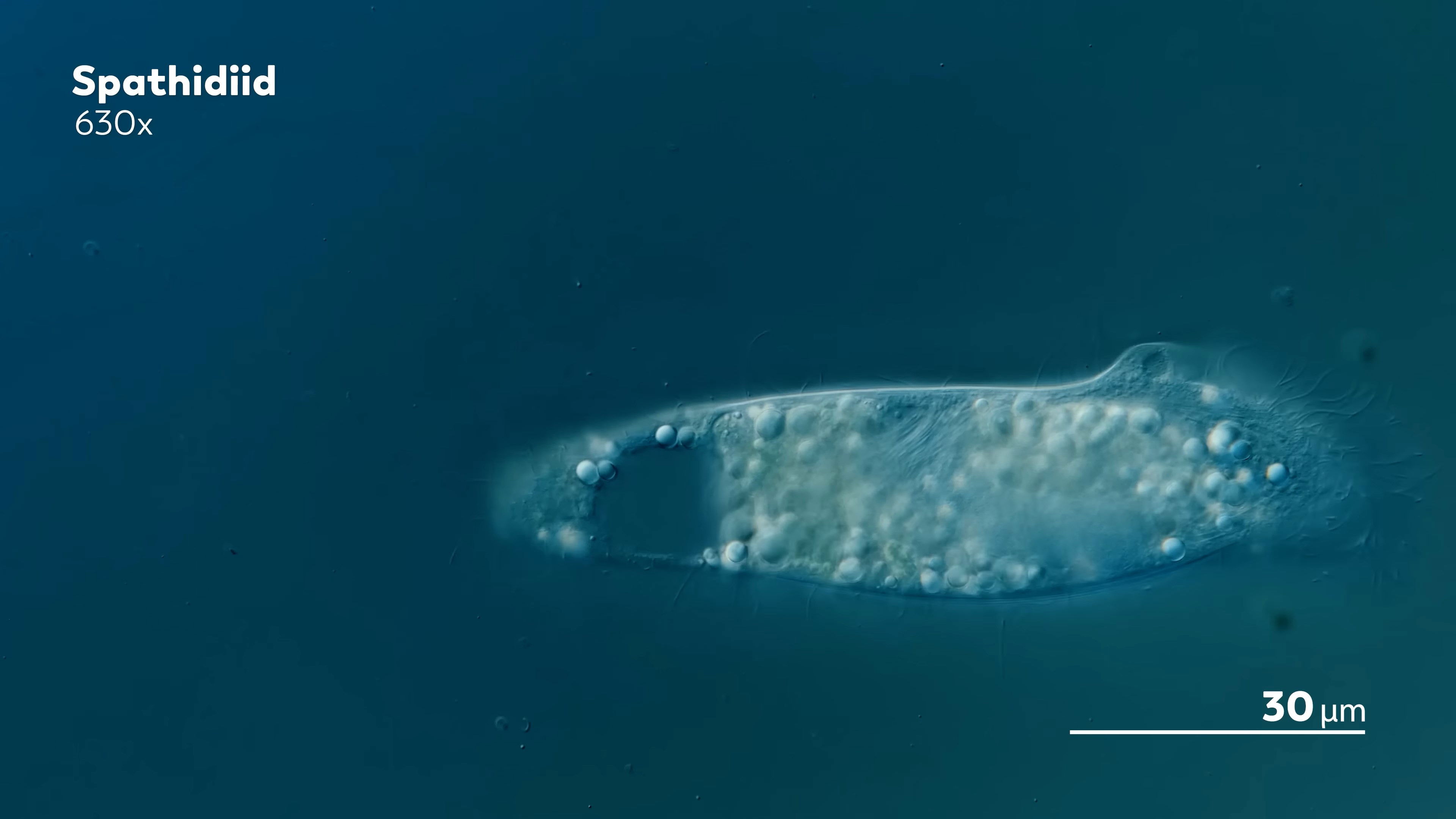 The Spatula-Shaped Ciliate Family
