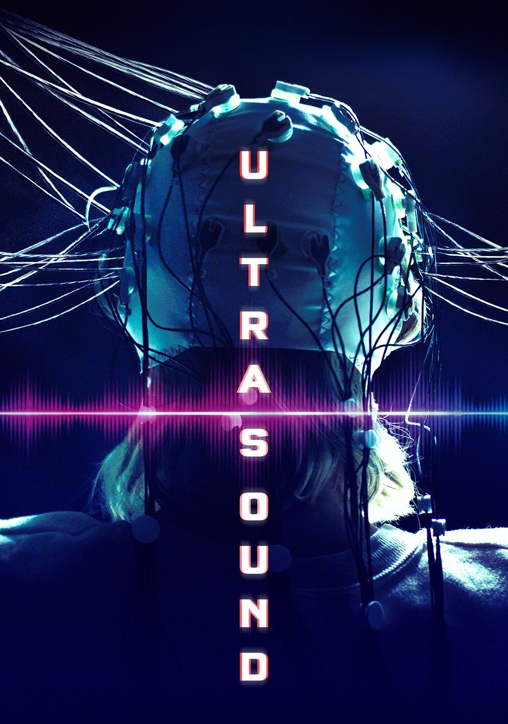 Ultrasound