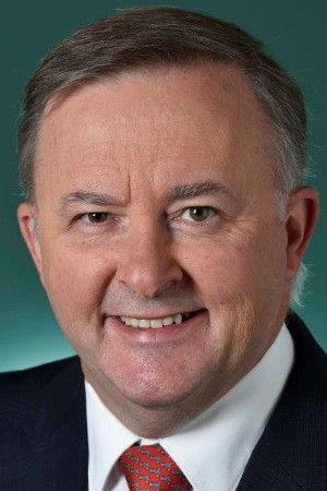 et billede af Anthony Albanese