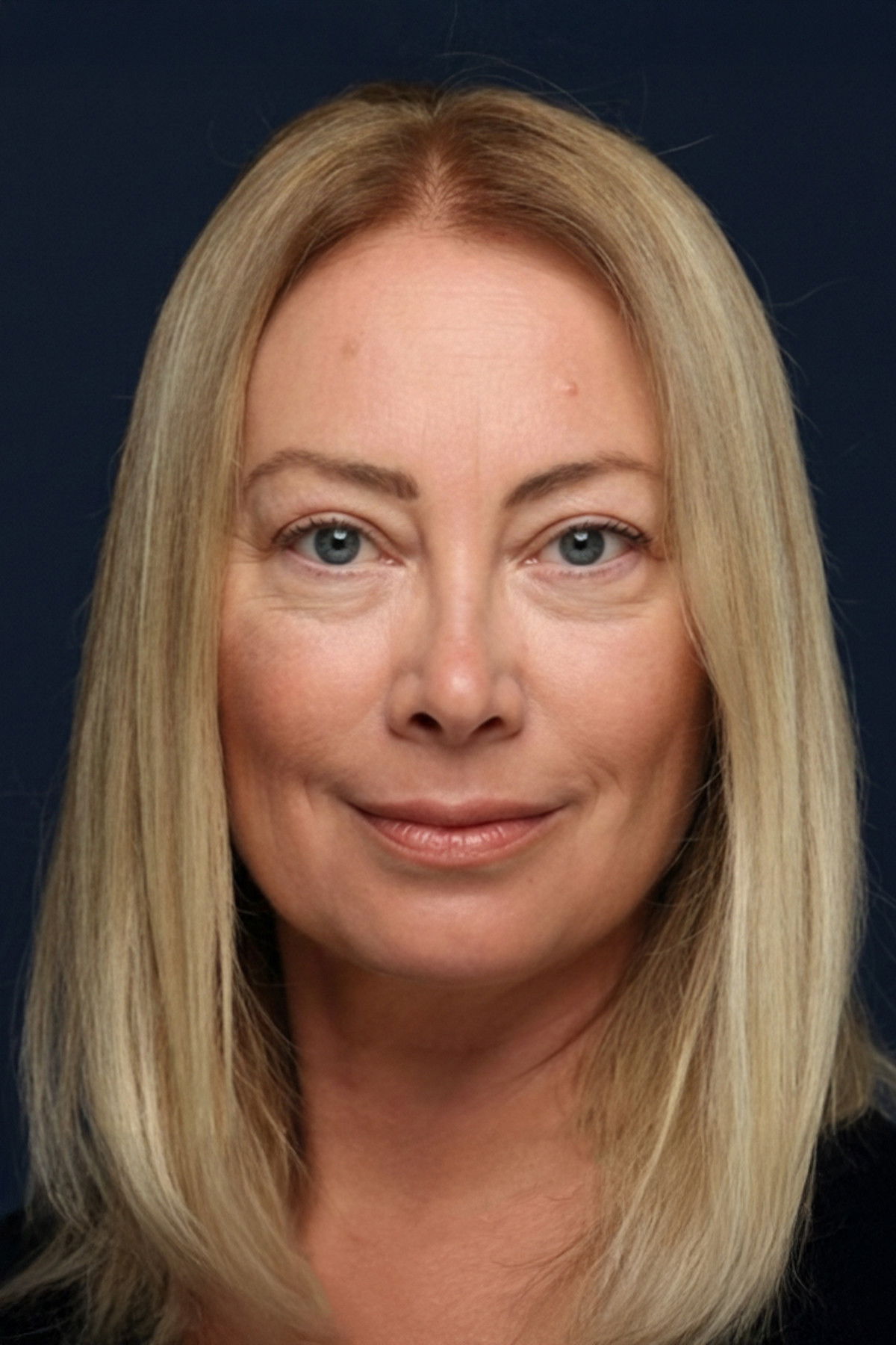 et billede af Alev Cınbarcı