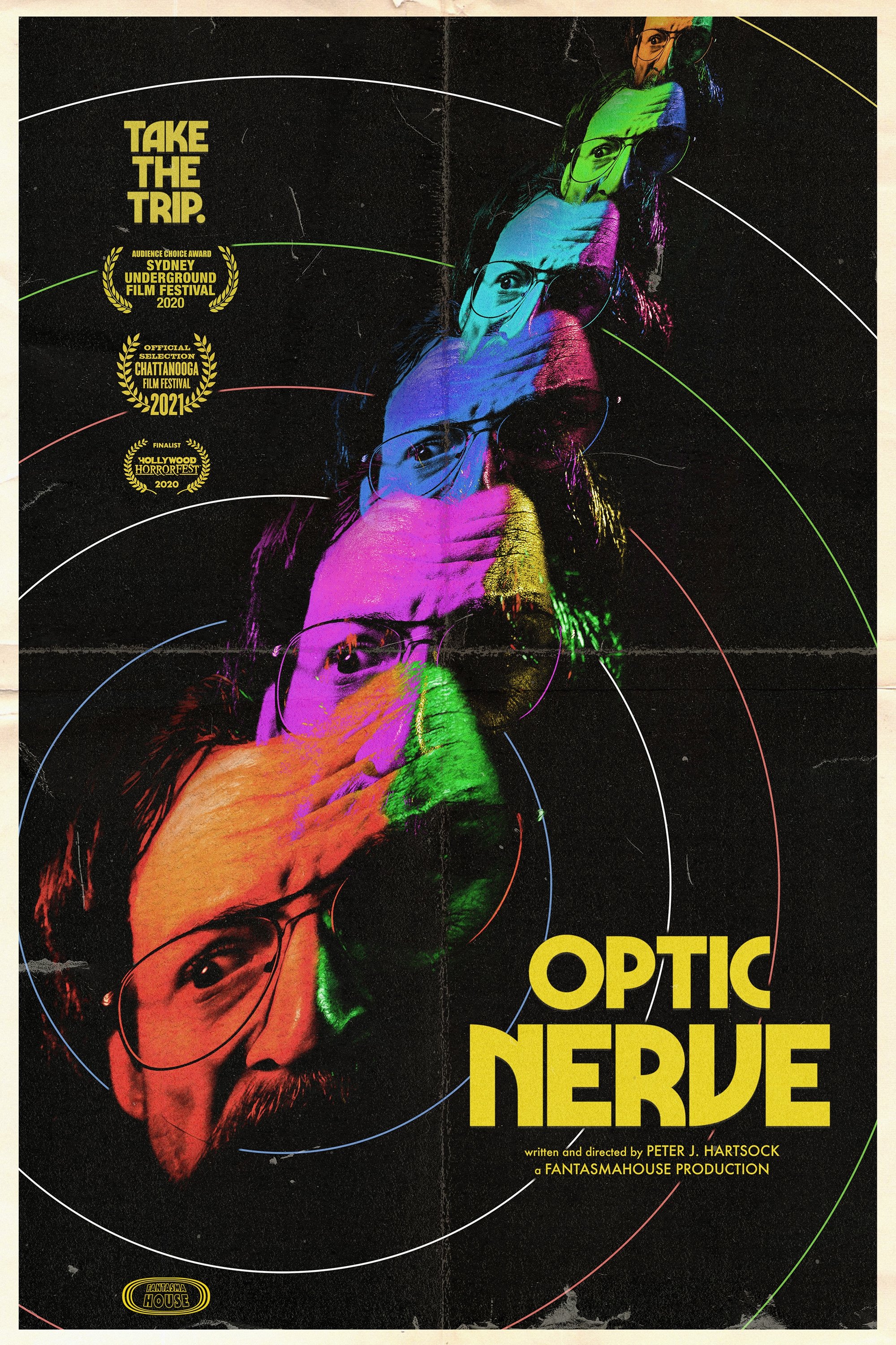 Optic Nerve Optic Nerve