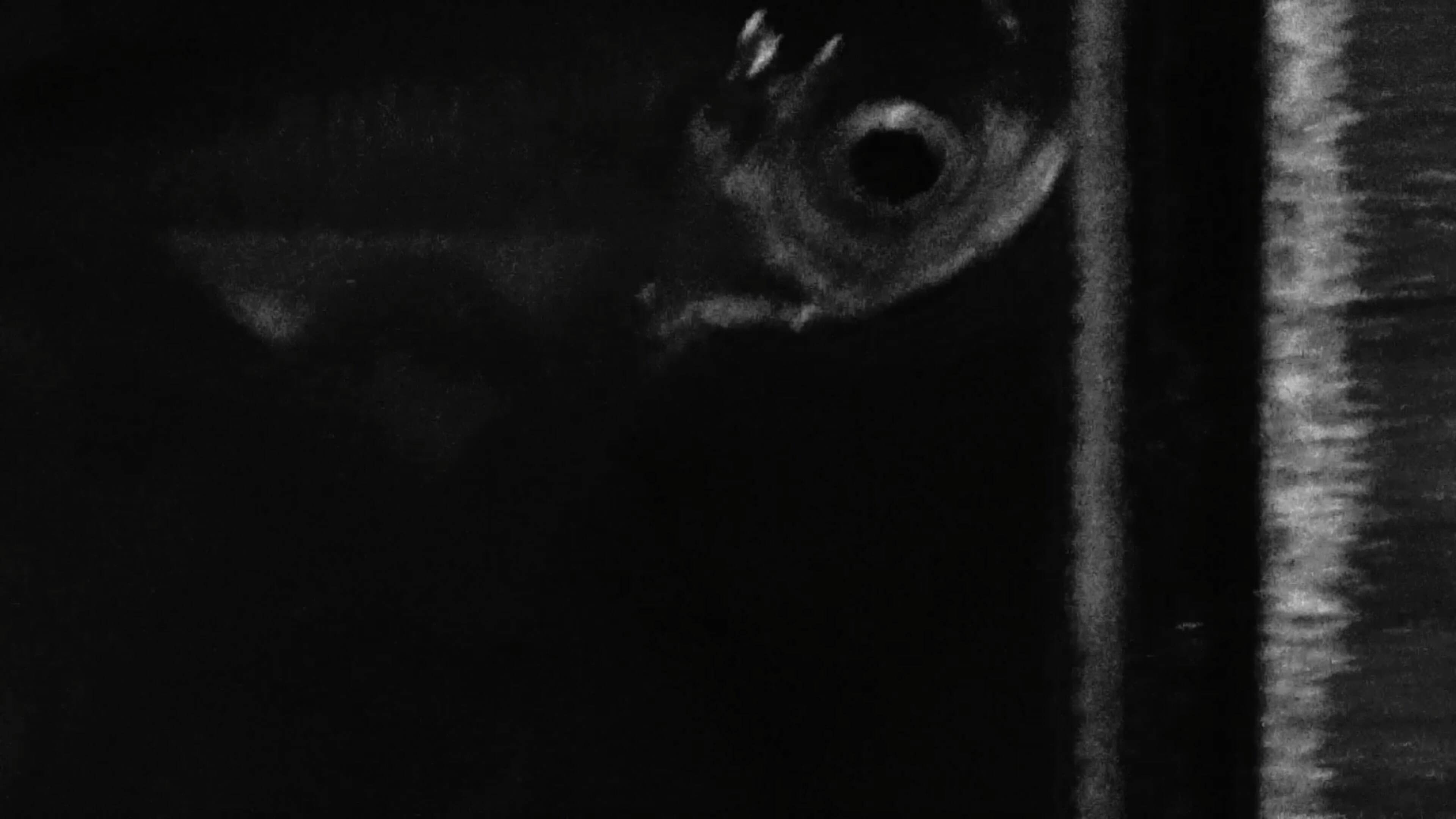Imagem do Filme Anomalies (Fibrosis)